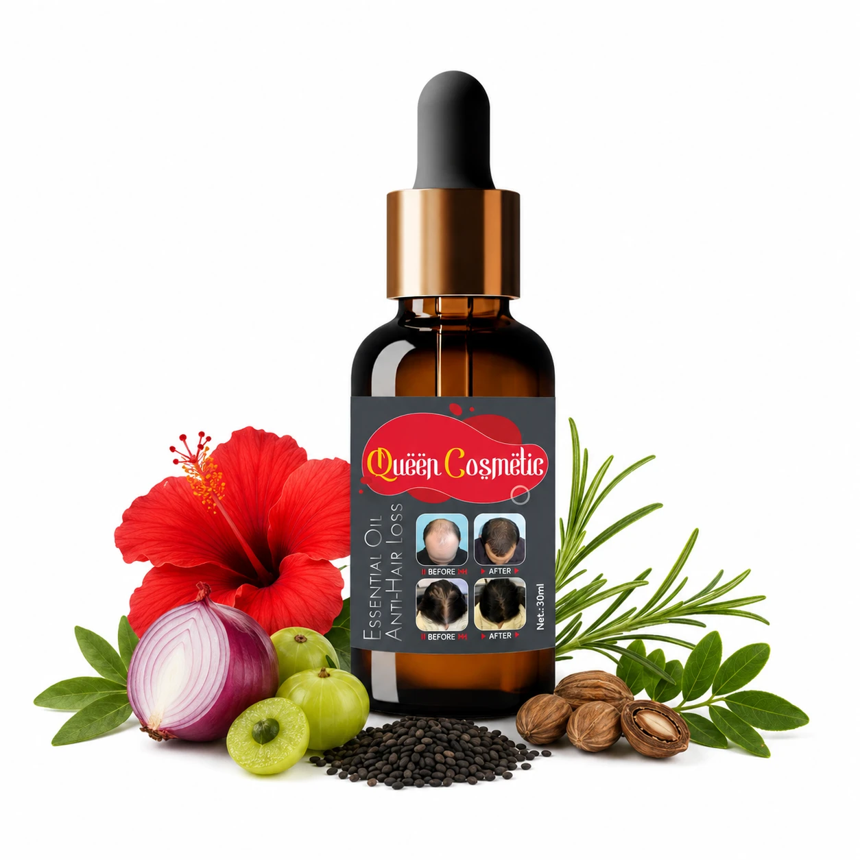 Queen Cosmetic Anti Hair Loss Essential Oil Hair G...